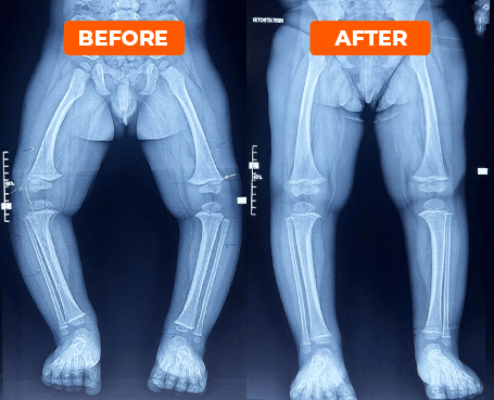 Rezultatele care vorbesc de la sine_Sinovita de sold